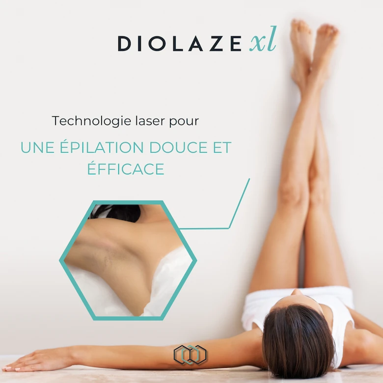 Avant après épilation au laser du visage - image 1 of 6