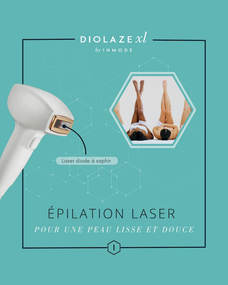 épilation laser peau foncée - image 5 of 6